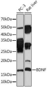 Western blot analysis of extracts of various cell lines, using Anti-BDNF Antibody [ARC0303] (A309102) at 1:1,000 dilution The secondary antibody was Goat Anti-Rabbit IgG H&L Antibody (HRP) at 1:10,000 dilution Lysates/proteins were present at 25 µg per lane