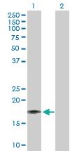 Anti-IL17F Rabbit Polyclonal Antibody