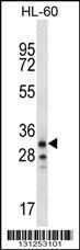 Anti-OR6K2 Rabbit Polyclonal Antibody