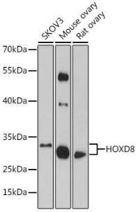 Western blot analysis of extracts of various cell lines, using Anti-HOXD8 Antibody (A93081) at 1:1,000 dilution The secondary antibody was Goat Anti-Rabbit IgG H&L Antibody (HRP) at 1:10,000 dilution Lysates/proteins were present at 25 µg per lane