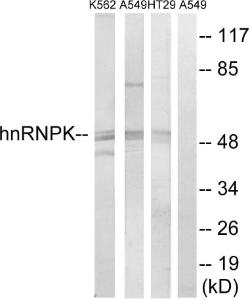 Anti-hnRNP K Rabbit Polyclonal Antibody