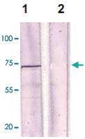 Anti-ESR1 Rabbit Polyclonal Antibody