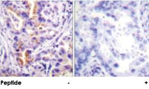 Anti-PRKCQ Rabbit Polyclonal Antibody