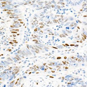 Anti-Cyclin E1 Rabbit Monoclonal Antibody [clone: ARC51383]