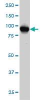 Anti-ATP2C1 Mouse Monoclonal Antibody [clone: 2G1]