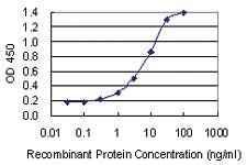 Anti-KDM6A Mouse Monoclonal Antibody [clone: 4E7]