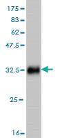 Anti-SMARCE1 Mouse Monoclonal Antibody [clone: 6G11]