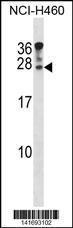 Anti-DUSP14 Rabbit Polyclonal Antibody (Biotin)