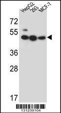 Anti-LIPJ Rabbit Polyclonal Antibody (Biotin)