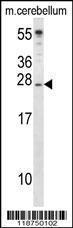 Anti-IGF2 Rabbit Polyclonal Antibody (Biotin)