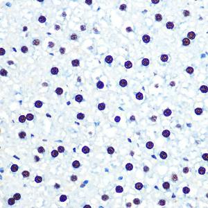 Immunohistochemistry analysis of paraffin-embedded rat liver using Anti-hnRNP U/p120 Antibody [ARC0942] (A307864) at a dilution of 1:100 (40X lens). Perform microwave antigen retrieval with 10 mM PBS buffer pH 7.2 before commencing with IHC staining protocol