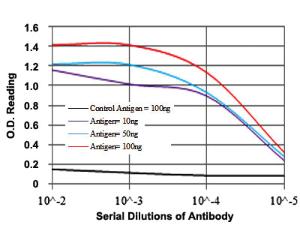 Anti-NEFL Mouse Monoclonal Antibody [clone: 1H3]