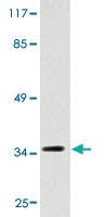 Anti-MC1R Rabbit Polyclonal Antibody