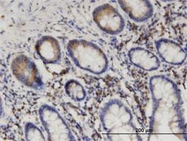 Anti-SEPT8 Mouse Monoclonal Antibody [clone: 1G3-7D1]