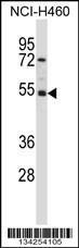 Anti-GTF2A1L Rabbit Polyclonal Antibody (AP (Alkaline Phosphatase))