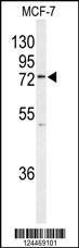 Anti-K0776 Rabbit Polyclonal Antibody (PE (Phycoerythrin))