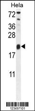 Anti-TRAPPC3 Rabbit Polyclonal Antibody