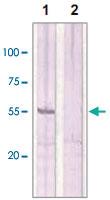 Anti-ESR2 Rabbit Polyclonal Antibody