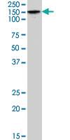 Anti-SLC12A4 Goat Polyclonal Antibody