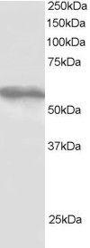 Anti-TRIM4 Antibody (A83384) staining (1 µg/ml) of HepG2 lysate (RIPA buffer, 30 µg total protein per lane). Primary incubated for 1 hour. Detected by western blot using chemiluminescence