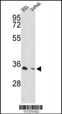 Anti-PSMD11 Rabbit Polyclonal Antibody