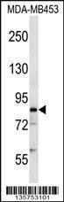 Anti-COL4A3BP Rabbit Polyclonal Antibody (HRP (Horseradish Peroxidase))