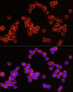 Immunofluorescence analysis of THP-1 cells using Anti-CD64 Antibody (A8886) at a dilution of 1:50 (40X lens). DAPI was used to stain the cell nuclei (blue)