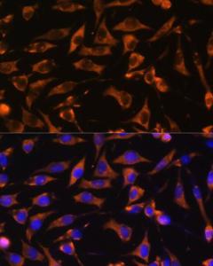 Immunofluorescence analysis of L929 cells using Anti-KANK1 Antibody (A93088) at a dilution of 1:100. DAPI was used to stain the cell nuclei (blue)