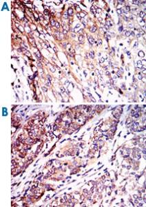 Anti-NEFL Mouse Monoclonal Antibody [clone: 1H3]