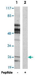 Anti-MOB4 Rabbit Polyclonal Antibody