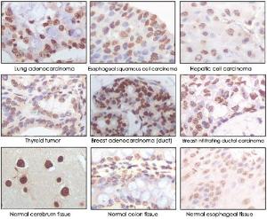 Anti-CDKN2A Mouse Monoclonal Antibody [clone: 5A8A4,3G8D12]