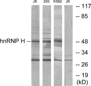 Anti-HNRPH2 Rabbit Polyclonal Antibody