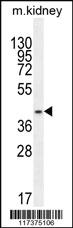 Anti-PSMD11 Rabbit Polyclonal Antibody