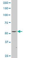 Anti-FLI1 Mouse Monoclonal Antibody [clone: 1H4]