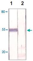 Anti-FOXP1 Rabbit Polyclonal Antibody