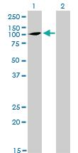 Anti-ATP2C1 Mouse Monoclonal Antibody [clone: 2G1]