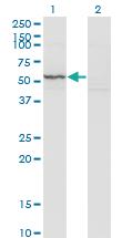 Anti-CK71 Mouse Monoclonal Antibody [clone: 1D4]