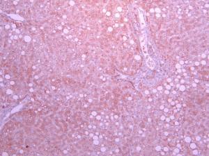 Anti-SLC5A1 Antibody (A85010) (10 µg/ml) staining of paraffin embedded Human Liver. Heat induced antigen retrieval with citrate buffer pH 6, HRP-staining