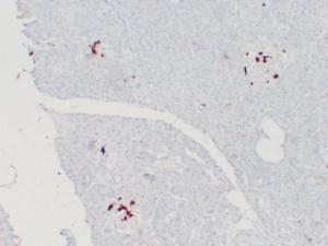 Immunohistochemical analysis of paraffin-embedded human Pancreas using Anti-Somatostatin Antibody