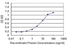 Anti-NEUROG1 Mouse Monoclonal Antibody [clone: 1F10]