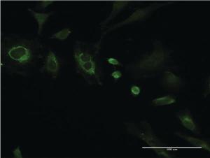 Anti-SEPT8 Mouse Monoclonal Antibody [clone: 1G3-7D1]