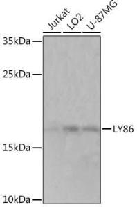 Western blot analysis of extracts of various cell lines, using Anti-MD1 Antibody (A93091) at 1:1,000 dilution