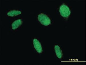 Anti-FLI1 Mouse Monoclonal Antibody [clone: 2F3]