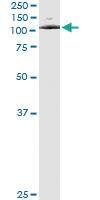 Anti-ATP2C1 Mouse Monoclonal Antibody [clone: 2G1]