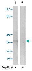 Anti-PPP1CA Rabbit Polyclonal Antibody