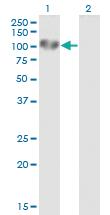 Anti-UVRAG Mouse Monoclonal Antibody [clone: 2E8]