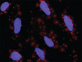 Anti-ETS1 + MAPK1 Antibody Pair