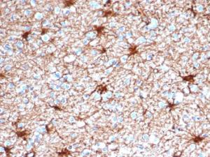 Immunohistochemical analysis of formalin-fixed, paraffin-embedded human cerebellum tissue using Anti-GFAP Antibody [GFAP/4450]