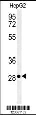 Anti-CHPT1 Rabbit Polyclonal Antibody