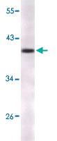 Anti-CDKN2A Mouse Monoclonal Antibody [clone: 5A8A4,3G8D12]